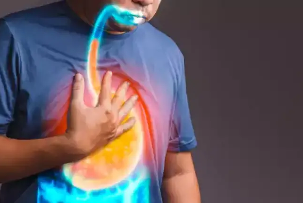 7 Surprising Triggers That Worsen Acid Reflux